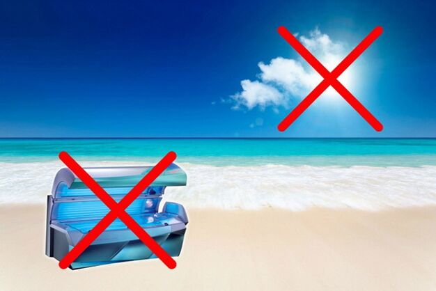 opalování s křečovými žilami