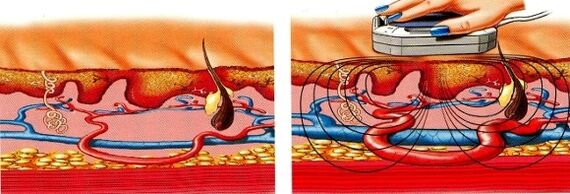 pokud vám znecitliví nohy